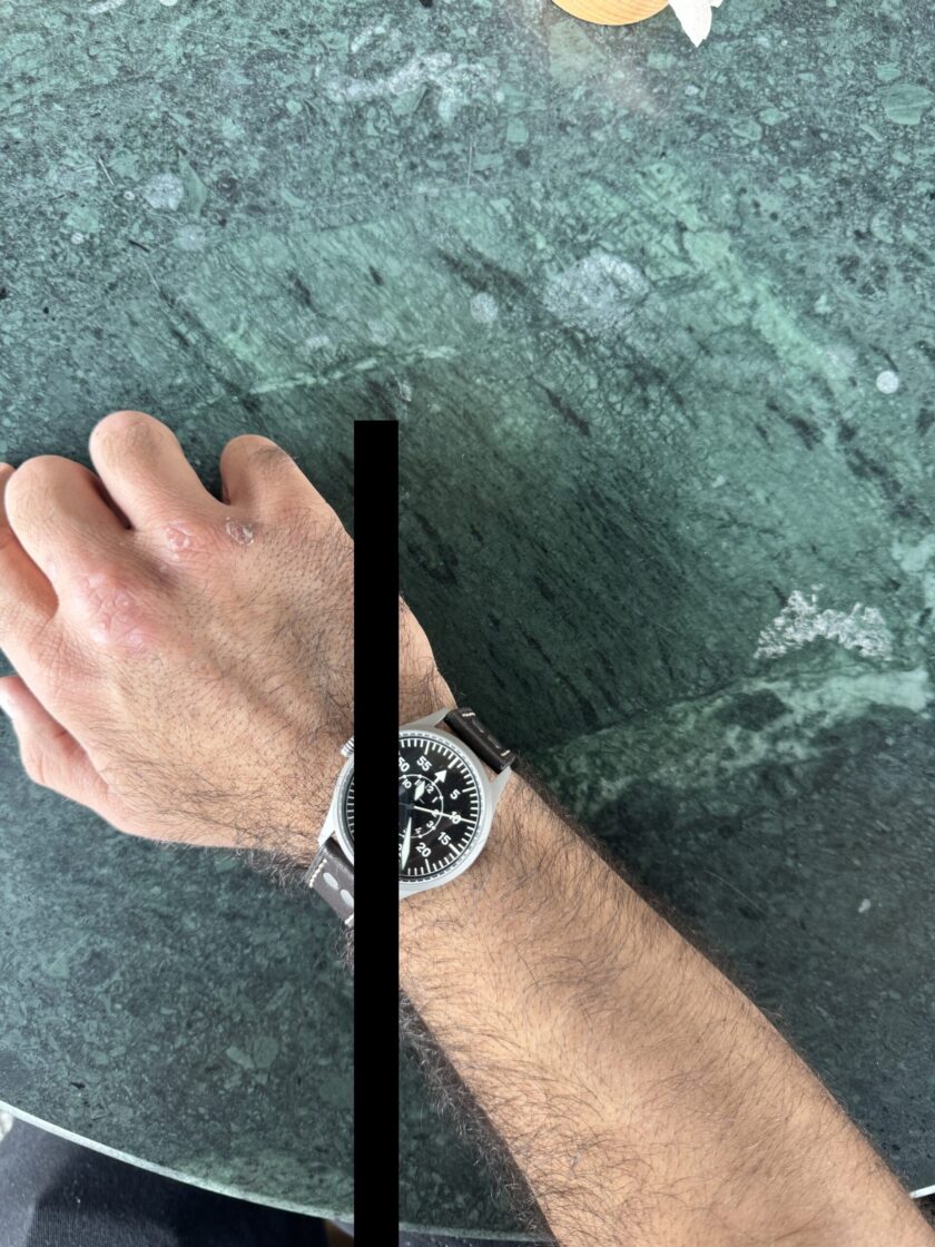 610 Watch (LHD) - Image 5